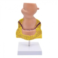 Rectum and Anal Canal Anatomical Model - Myaskro