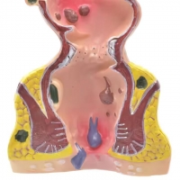 Rectum and Anal Canal Anatomical Model - Myaskro