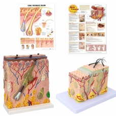 Skin Anatomy and Pathology Bundle (2 Skin Models + 2 Charts) - Myaskro