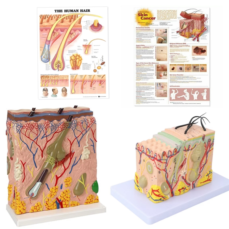 Skin Anatomy and Pathology Bundle (2 Skin Models + 2 Charts) - Myaskro