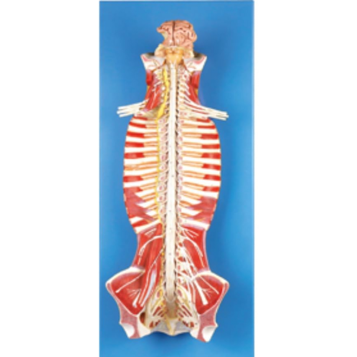 Spinal Cord In Spinal Canal Model - MYASKRO