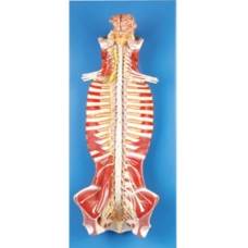 Spinal Cord In Spinal Canal Model - MYASKRO