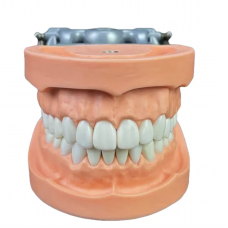 Dental Typodont Model With 32 Teeth and Screw Driver - MYASKRO