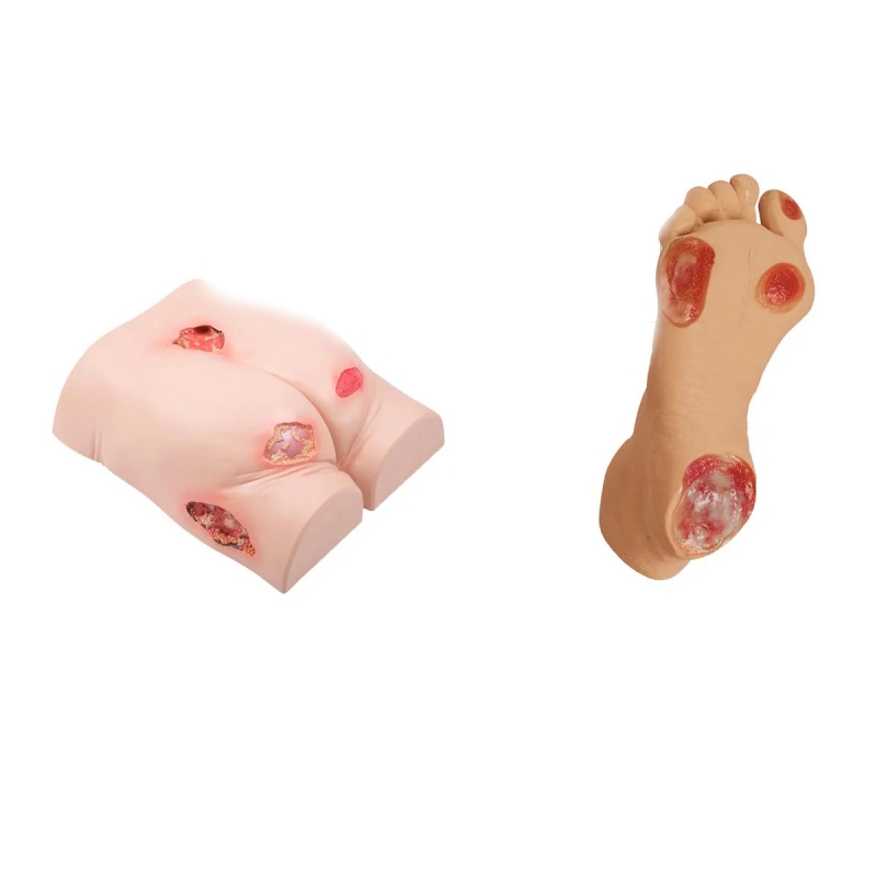 Pressure Ulcers Bundle - Myaskro