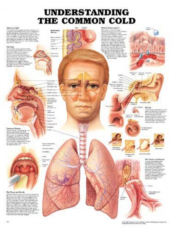 Common Cold Chart (51x66cm) With Hard Backing, Aluminium Frame & Hanging Hooks