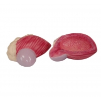 Urinary Bladder Expansion Model - MYASKRO