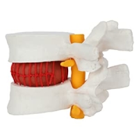 Lower Back Pain Models + Chart Bundle | 85cm Spine Model, Lumbar Herniated Disc Model & Pelvis with 2 vertebrae